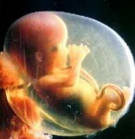 Prečo sa to stáva?